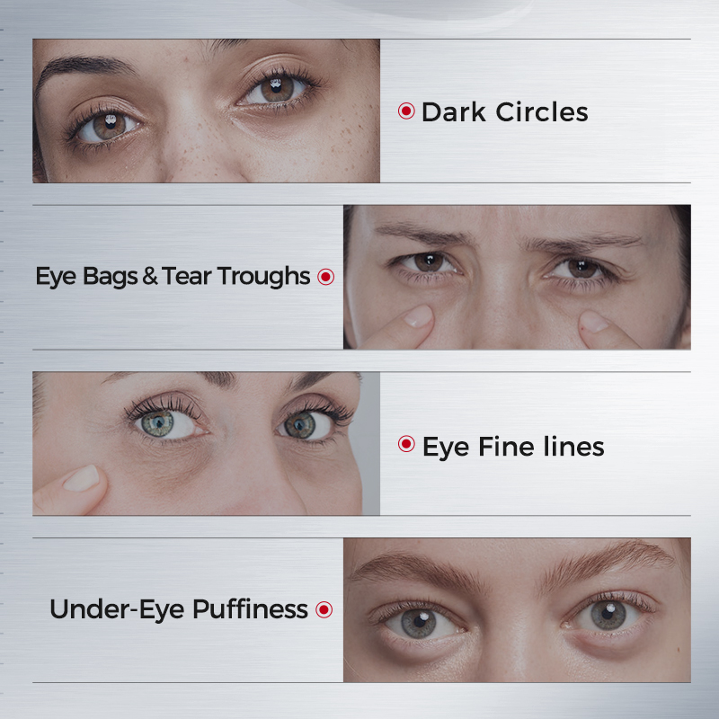 Eye Patches for Dark Circles – - Eye Pad Collagen 评论和价格