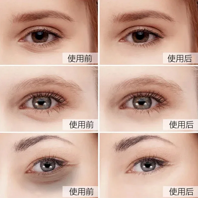 5pair Gold Eye Mask Patches Cr - Eye Pad Collagen 评论和价格